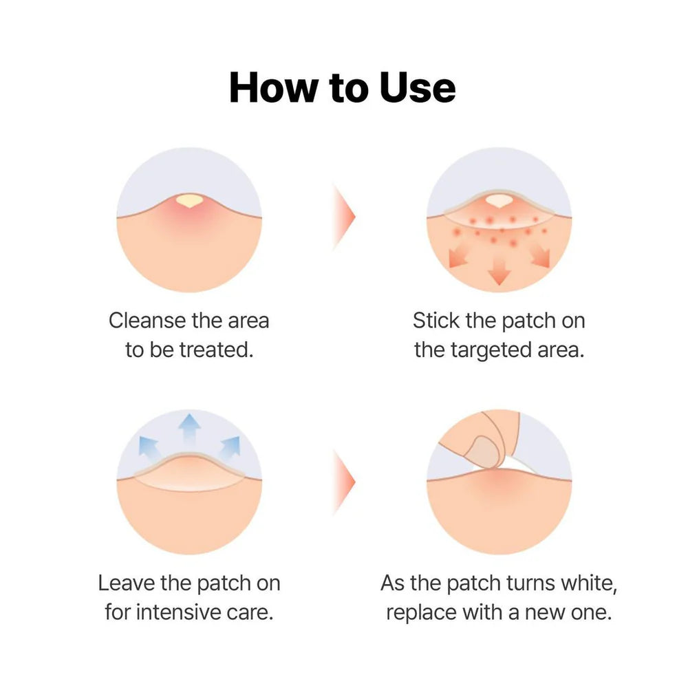 COSRX Master Patch Hydrocolloid Patches Set