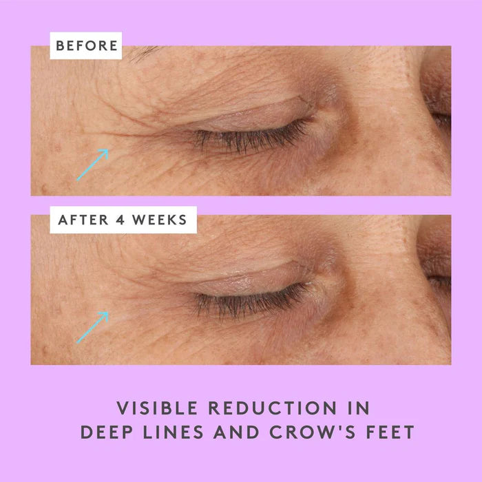 Drunk Elephant Ceramighty AF Eye Balm