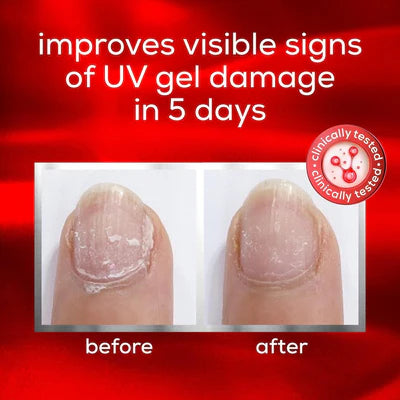 Essie To The Rescue UV Gel Damage Repair
