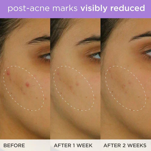 TATCHA The Brightening Serum