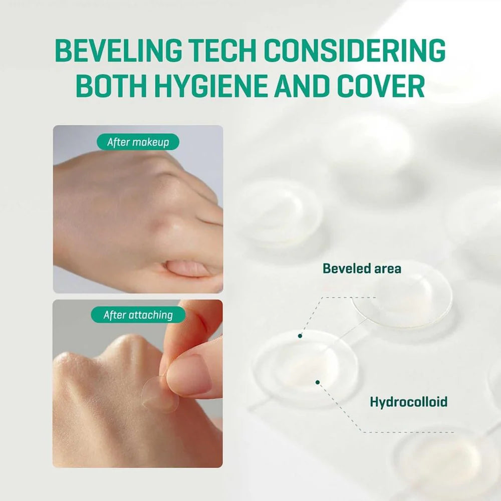 SOME BY MI Clear Spot Patch