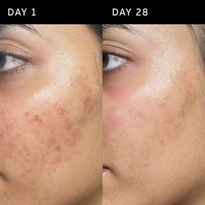 INKEY Ectoin Hydro-Barrier Serum