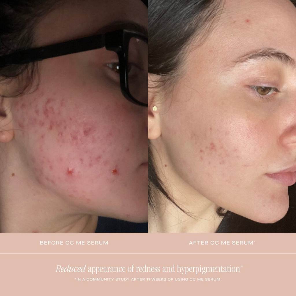 Summer Fridays CC Me Vitamin C + Niacinamide Serum