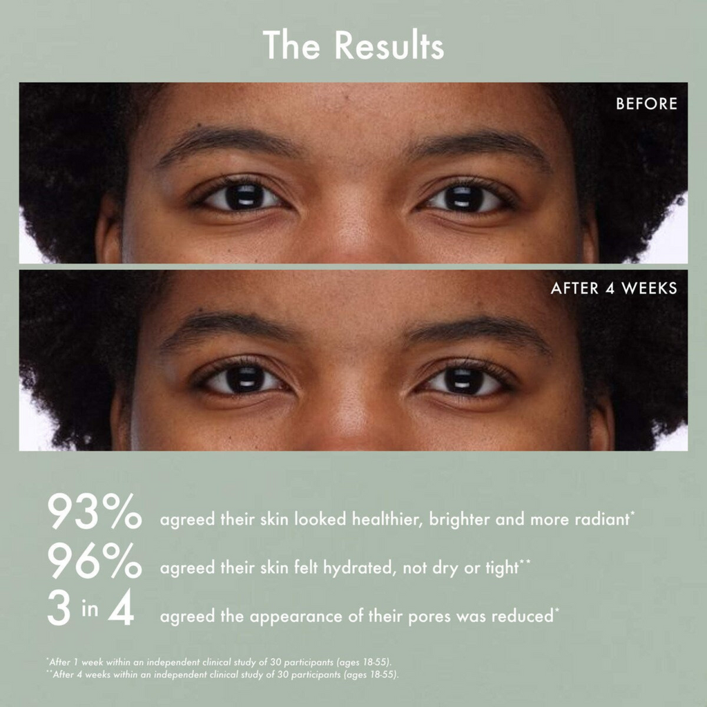 Summer Fridays Gentle Reset Daily Exfoliating Pads to Smooth + Minimize Pores with AHAs