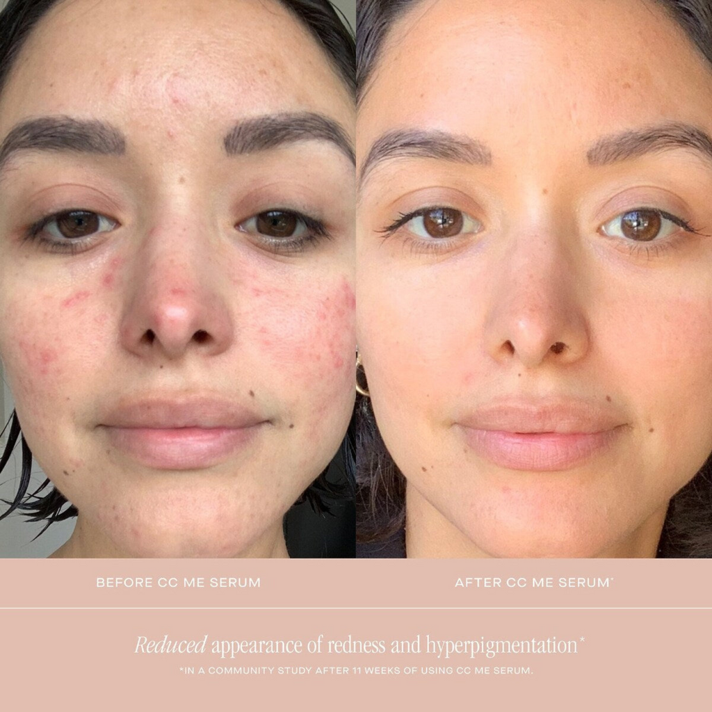 Summer Fridays CC Me Vitamin C + Niacinamide Serum