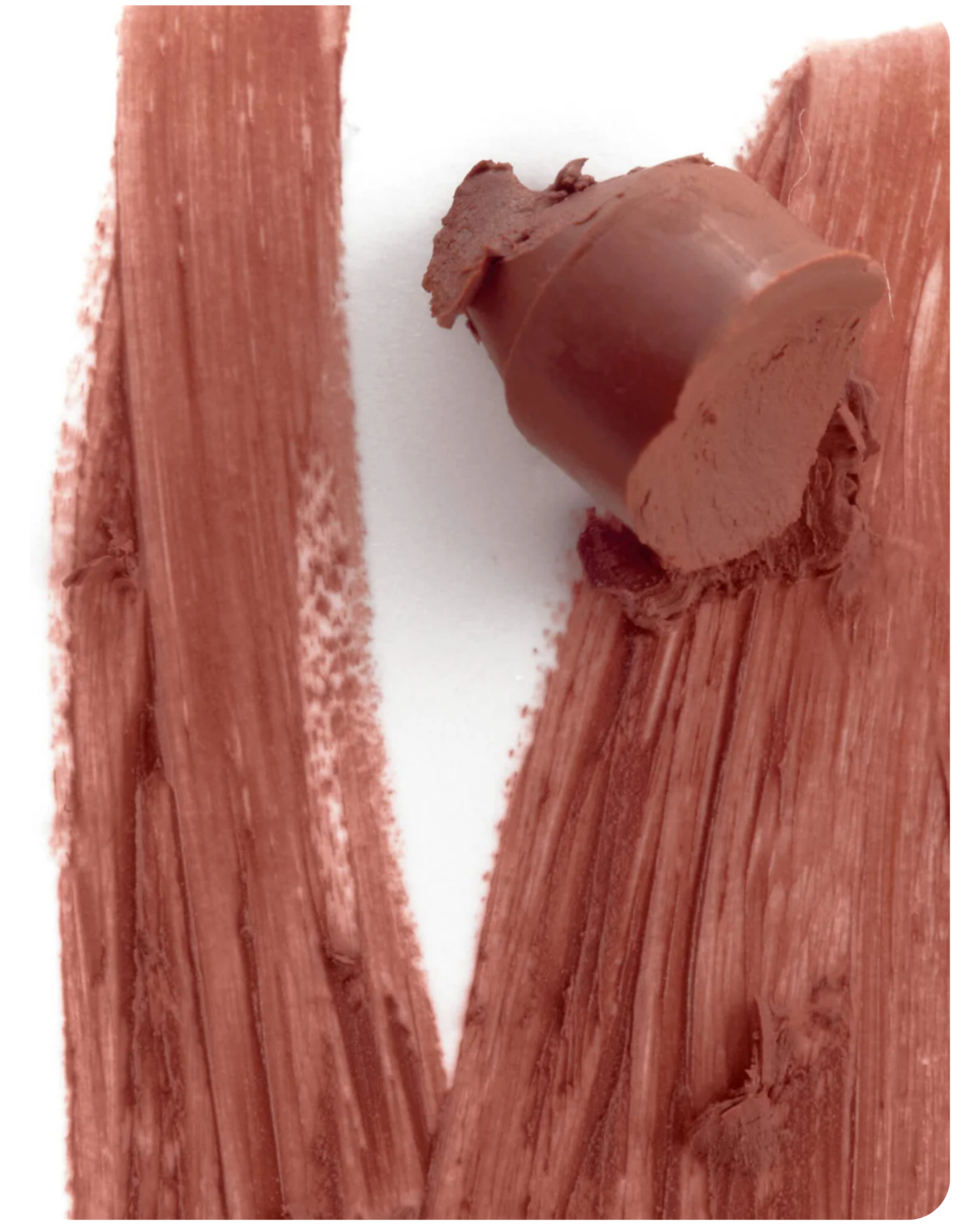 Rhode Peptide Lip Shape