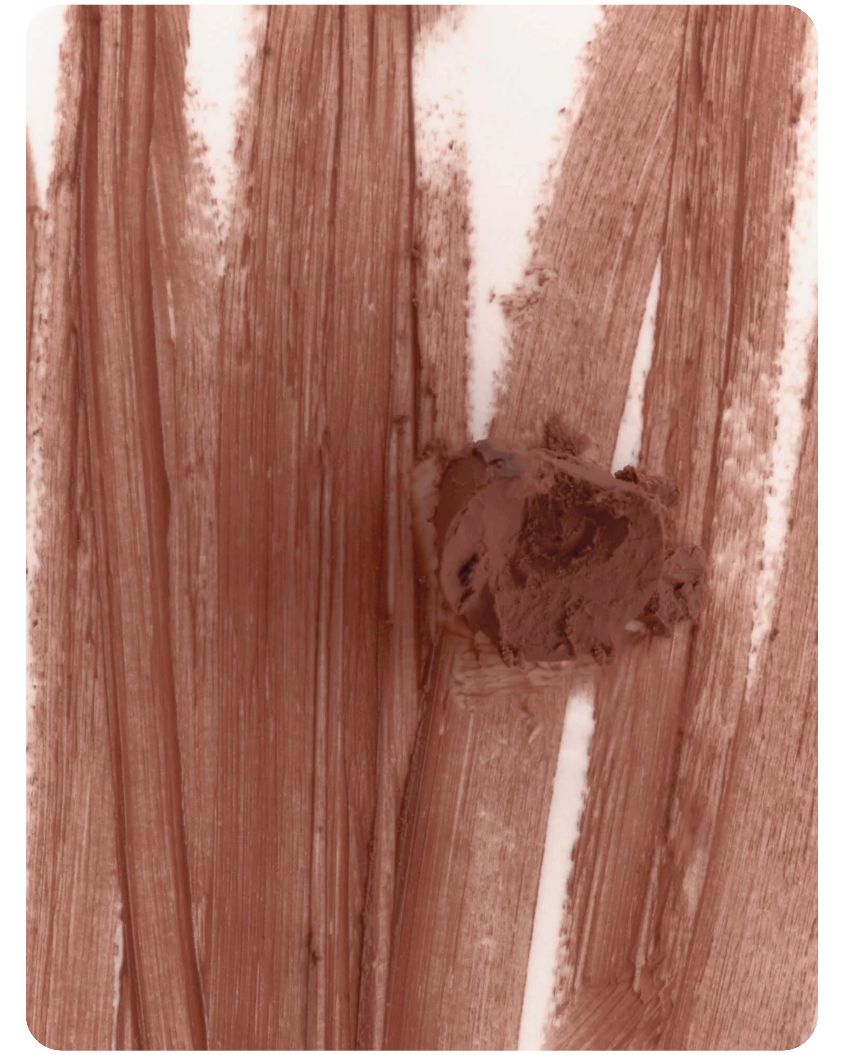 Rhode Peptide Lip Shape